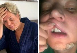 Encerrado: Polícia Legislativa finaliza perícia em câmeras do prédio de Joice Hasselmann