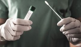 Média móvel de mortes por Covid-19 atinge alta de 116% em Alagoas