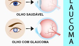 No mês do combate ao Glaucoma, população terá atendimento gratuito
