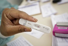 Anvisa aprova uso e comercialização de autoteste para Covid-19