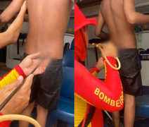 Adolescente é atingido por arpão durante pesca subaquática na Praia do Francês