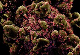 Alagoas registra 2.384 óbitos por Covid-19