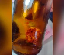 Homem diz ter encontrado um “dedo” dentro de cerveja: “Tinha até unha”