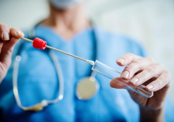 Exame RT-PCR será prescrito para alagoanos com Síndrome Gripal