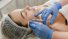 CFO proíbe uso de PMMA para fins estéticos por cirurgiões-dentistas