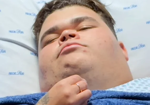 Gordão da XJ realiza processo cirúrgico delicado após perder mais de 130 kg