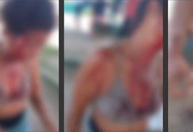Três pessoas são esfaqueadas durante briga em interior de AL