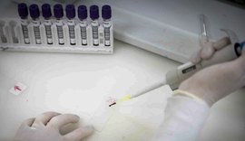 Secretaria de Saúde de SP apura novo caso suspeito de ebola