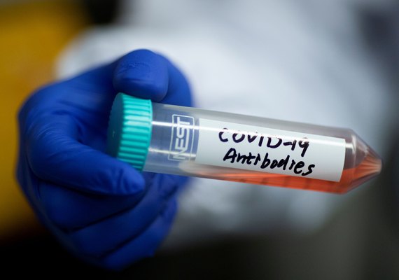 Pesquisadores encontram anticorpo que neutraliza coronavírus