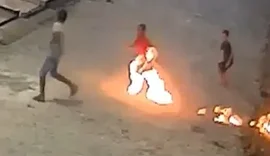'Pedindo forças a Deus': Mãe de menino ferido por fogos em AL relata desespero