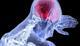 Cientistas apontam 7 hábitos para evitar AVC; Saiba quais