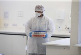 Cientistas em Hong Kong confirmam caso de reinfecção pelo coronavírus