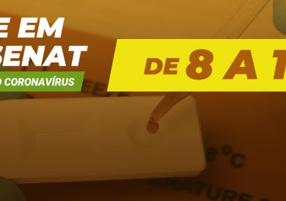 SEST/SENAT vai realizar testes rápidos de covid-19 em trabalhadores do transporte