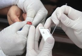 Farmácias de Alagoas devem oferecer testes rápidos de Covid-19 em 15 dias