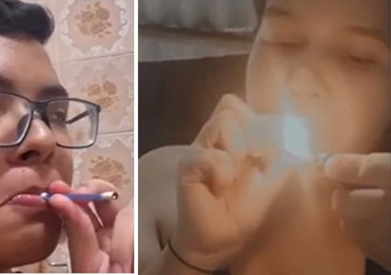 Fumar cotonetes: moda entre adolescentes pode desencadear doenças graves respiratórias