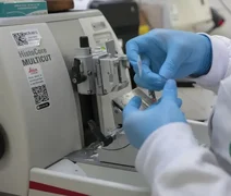 Cura do câncer de próstata pode alcançar 98%, aponta especialista da Sociedade Brasileira de Urologia