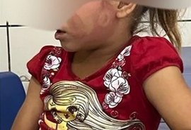 Homem é preso por agredir filha de 6 anos em Taquarana; criança foi encontrada com hematoma no rosto