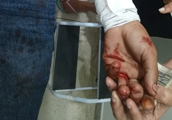 Em AL, homem é esfaqueado no peito e suspeito é detido pela Guarda Municipal
