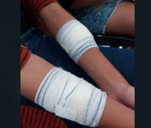 Estudantes ficam feridas após briga com estilete dentro de ônibus escolar em Arapiraca