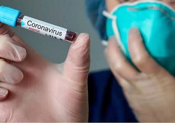 Alagoas registra 19 novas mortes por Covid-19