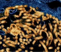OMS confirma primeira recuperação de paciente no atual surto de ebola no Congo