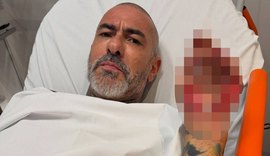 Fogaça revela que quase morreu em acidente de moto: 'Peguei óleo na pista'