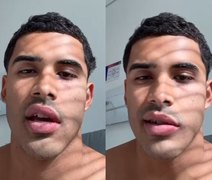 Cantor Nilo pausa carreira após diagnóstico de paralisia de Bell