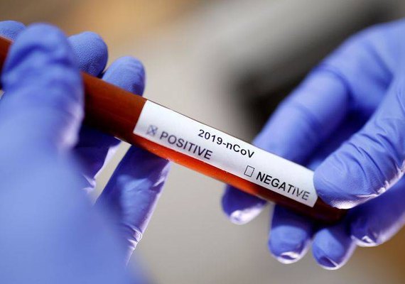 Alagoas tem 35,3 mil casos curados da Covid-19