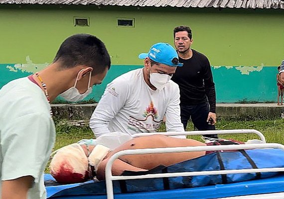 Um indígena é morto e dois são feridos em ataque na Terra Yanomami