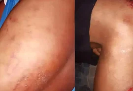 Família pede Justiça após jovem ser agredido por Guarda Municipal em São José da Laje