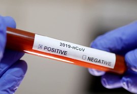 Brasil registra uma morte por minuto por Covid-19