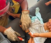 Menino de 3 anos fica preso em sofá após brincar com supercola