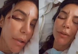 Ivete Sangalo desmaia em casa, é internada e tranquiliza fãs em Salvador