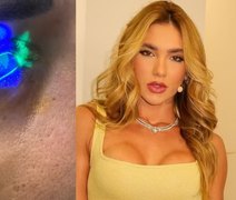 Mulher afirma ter ficado cega após usar produto de Virginia Fonseca