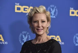 Atriz Anne Heche sofreu lesão cerebral e não deve sobreviver
