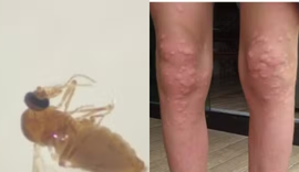 Conheça o mosquito que fez moradores em SC se 'trancarem' em casa