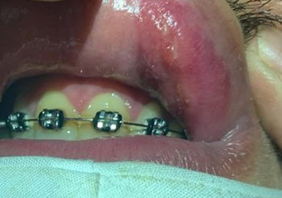 Presidente da AME denuncia caso de transfobia em Maceió