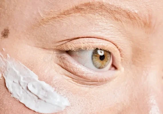 Pessoas com albinismo têm acesso gratuito a protetor solar em Maceió