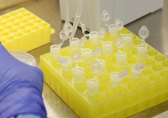 Britânicos que produzem vacina farão testes com 10 mil pessoas