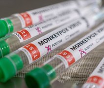 Ministro diz que Brasil terá antiviral para tratar varíola dos macacos