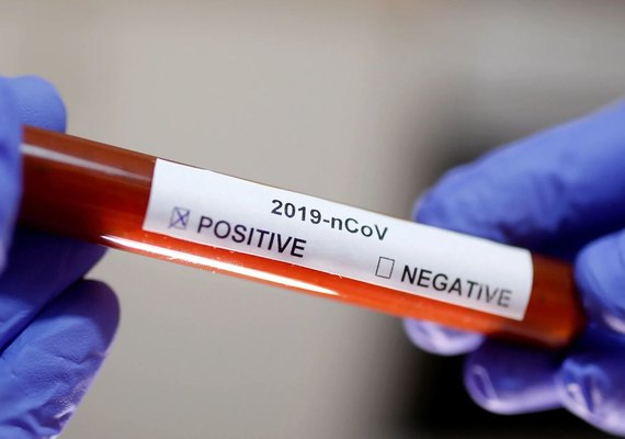 Brasil registra uma morte por minuto por Covid-19