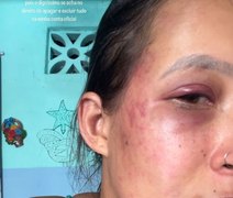Mulher denuncia companheiro por violência doméstica após recusar ter relação sexual