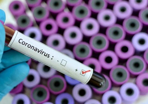 Casos da Covid-19 chegam a 67.613 em Alagoas