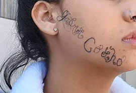 Ex-namorado tatua o próprio nome no rosto de menina à força