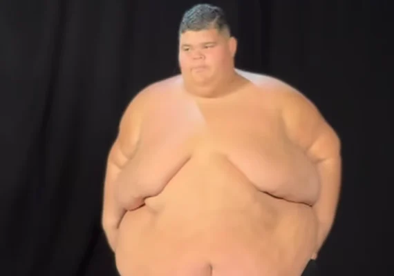 Gordão da XJ mostra antes e depois após perder 130 kg