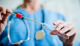 Exame RT-PCR será prescrito para alagoanos com Síndrome Gripal
