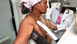 Santana volta a ofertar exames de Mamografia depois de 4 anos e realiza 463 atendimentos