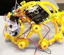 Interface cérebro-computador é pesquisada para diagnóstico de epilepsia, depressão e outras doenças