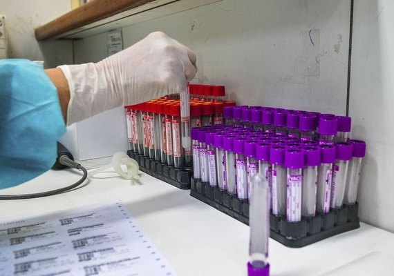 Covid-19: Alagoas registra 90.384 casos e 2.221 óbitos