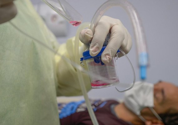 Sesau confirma teste positivo para covid-19 em óbito desta segunda (31)